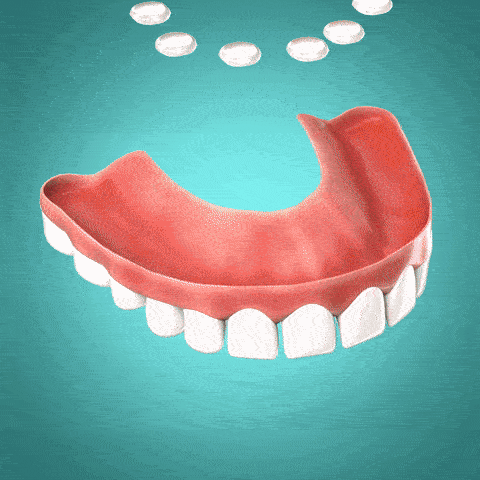 🎁 Custom Fit Denture Kit – Easy DIY Solution