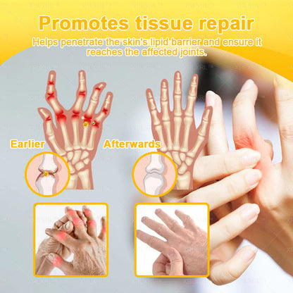 Elderly Arthritis Relief Bee Venom Cream | Repair Bone & Joint Discomfort Naturally