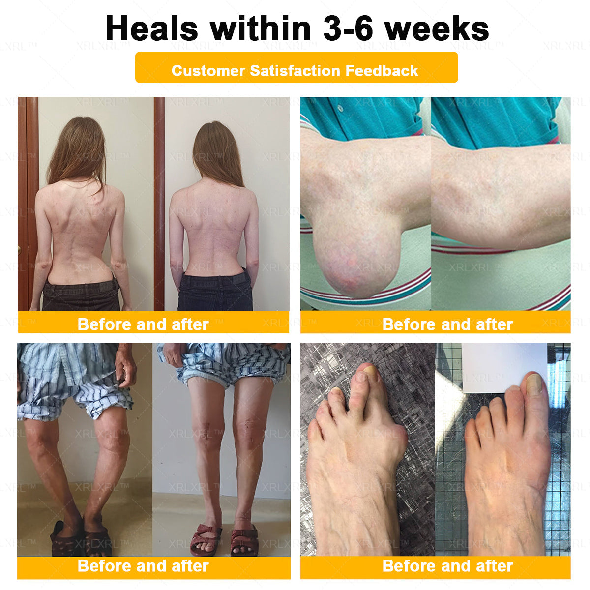 Elderly Arthritis Relief Bee Venom Cream | Repair Bone & Joint Discomfort Naturally