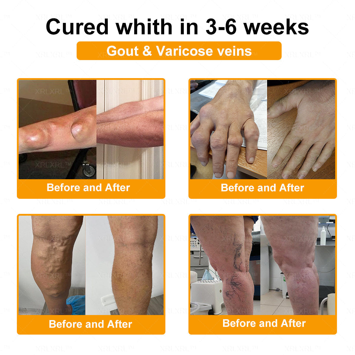 Elderly Arthritis Relief Bee Venom Cream | Repair Bone & Joint Discomfort Naturally