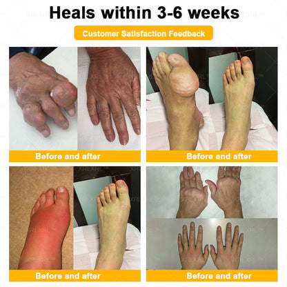 Elderly Arthritis Relief Bee Venom Cream | Repair Bone & Joint Discomfort Naturally
