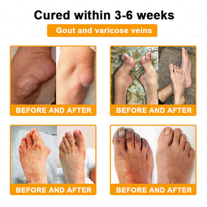 Elderly Arthritis Relief Bee Venom Cream | Repair Bone & Joint Discomfort Naturally