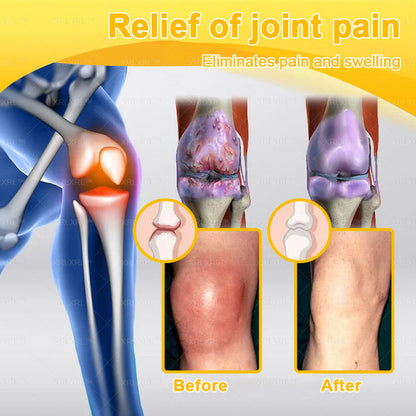 Elderly Arthritis Relief Bee Venom Cream | Repair Bone & Joint Discomfort Naturally